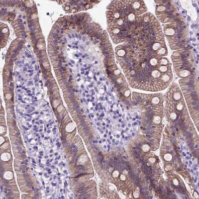 Immunohistochemistry-Paraffin: E-Cadherin Antibody (CL1180) [NBP2-34477]