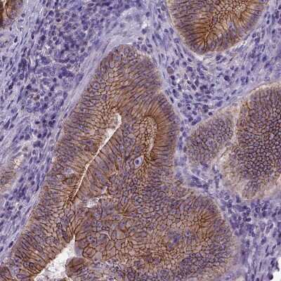 Immunohistochemistry-Paraffin: E-Cadherin Antibody (CL1180) [NBP2-34477]