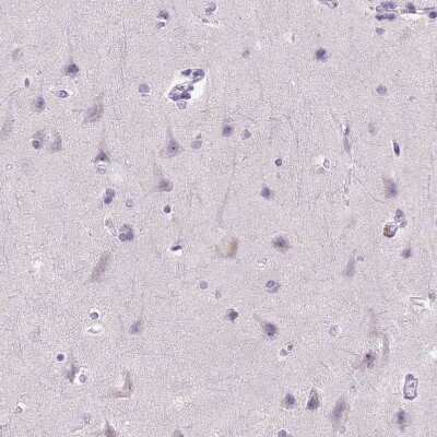 Immunohistochemistry-Paraffin: E-Cadherin Antibody (CL1180) [NBP2-34477]