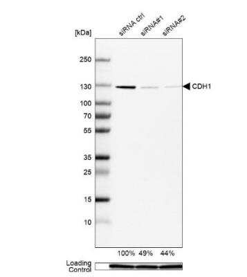 Western Blot: E-Cadherin Antibody (CL1180) [NBP2-34477]