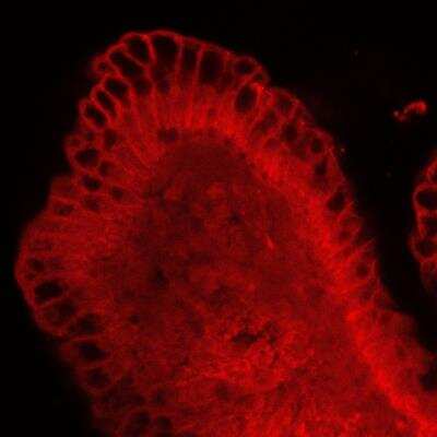 Immunocytochemistry/ Immunofluorescence: E-Cadherin Antibody (DECMA-1) [NB120-11512]
