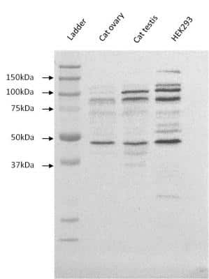 Western Blot: E-Cadherin Antibody (DECMA-1) [NB120-11512]