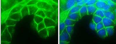 Immunocytochemistry/ Immunofluorescence: E-Cadherin Antibody [NBP2-16258]