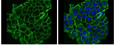Immunocytochemistry/ Immunofluorescence: E-Cadherin Antibody [NBP2-16258]