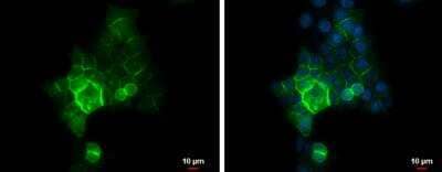 Immunocytochemistry/ Immunofluorescence: E-Cadherin Antibody [NBP2-16258]