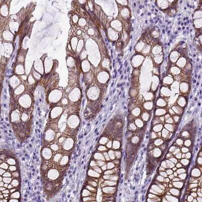 Immunohistochemistry-Paraffin: E-Cadherin Antibody [NBP1-84588]