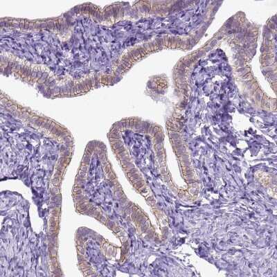 Immunohistochemistry-Paraffin: E-Cadherin Antibody [NBP1-84588]
