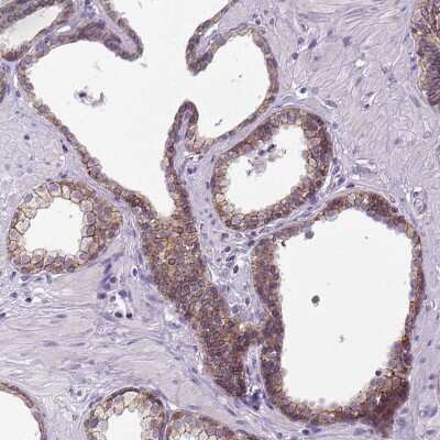 Immunohistochemistry-Paraffin: E-Cadherin Antibody [NBP1-84588]