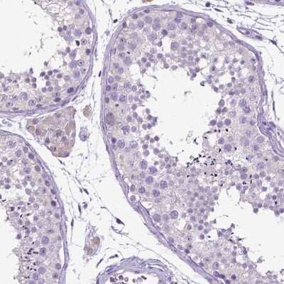 Immunohistochemistry-Paraffin: E-Cadherin Antibody [NBP1-84588]