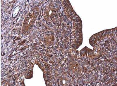 Immunohistochemistry-Paraffin: E-Cadherin Antibody [NBP2-16258]