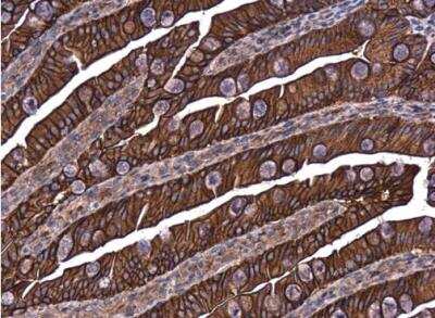 Immunohistochemistry-Paraffin: E-Cadherin Antibody [NBP2-16258]