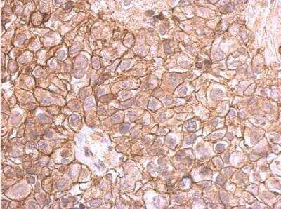 Immunohistochemistry-Paraffin: E-Cadherin Antibody [NBP2-16258]