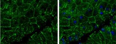 Immunohistochemistry-Paraffin: E-Cadherin Antibody [NBP2-16258]