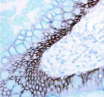 Immunohistochemistry-Paraffin: E-Cadherin Antibody [NBP2-16258]