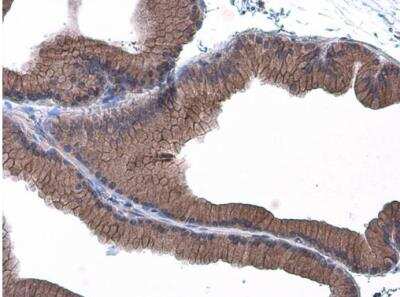 Immunohistochemistry-Paraffin: E-Cadherin Antibody [NBP2-16258]