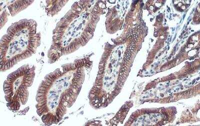 Immunohistochemistry-Paraffin: E-Cadherin Antibody [NBP2-16258]