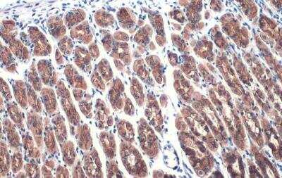 Immunohistochemistry-Paraffin: E-Cadherin Antibody [NBP2-16258]