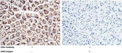 Immunohistochemistry-Paraffin: E-Cadherin Antibody [NBP2-98336]