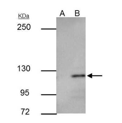 Immunoprecipitation: E-Cadherin Antibody [NBP2-16258]