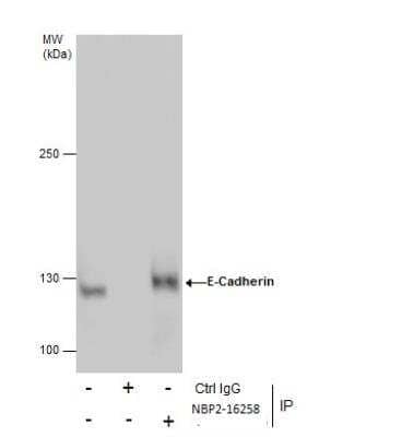 Immunoprecipitation: E-Cadherin Antibody [NBP2-16258]