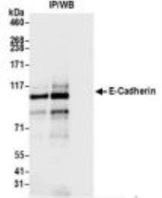 Immunoprecipitation: E-Cadherin Antibody (BLR088G) [NBP3-14687]