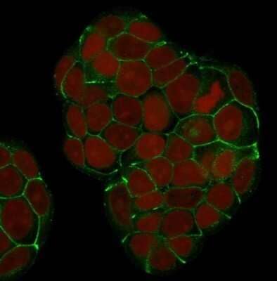 Immunocytochemistry/ Immunofluorescence: E-Cadherin Antibody (SPM381) - Azide and BSA Free [NBP2-54372]