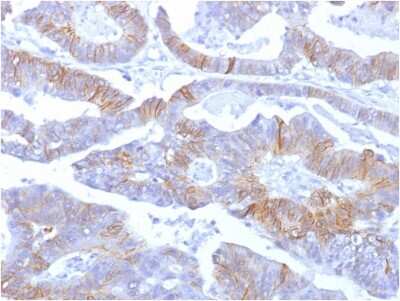 Immunohistochemistry-Paraffin: E-Cadherin Antibody (SPM381) - Azide and BSA Free [NBP2-54372]