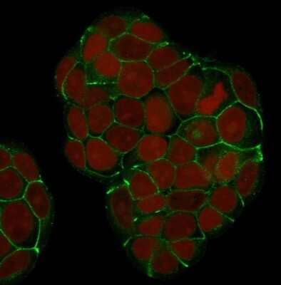 Immunocytochemistry/ Immunofluorescence: E-Cadherin Antibody (SPM381) [NBP2-53230]