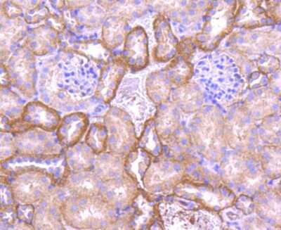 Immunohistochemistry-Paraffin: E-Cadherin Antibody (ST54-01) [NBP2-67540]