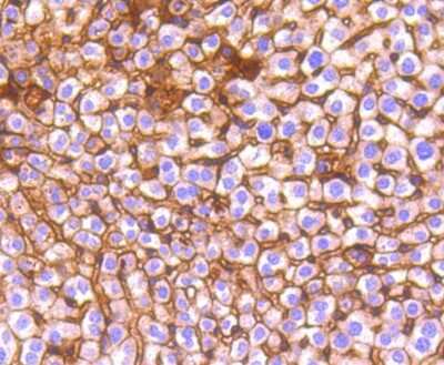 Immunohistochemistry-Paraffin: E-Cadherin Antibody (ST54-01) [NBP2-67540]