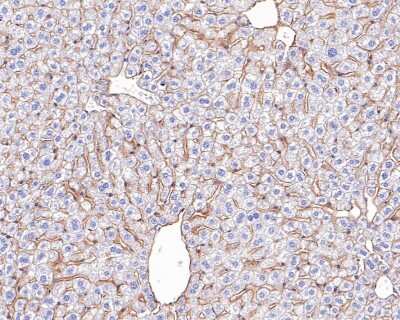 Immunohistochemistry-Paraffin: E-Cadherin Antibody (ST54-01) [NBP2-67540]
