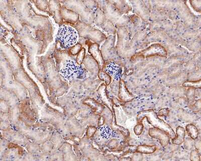 Immunohistochemistry-Paraffin: E-Cadherin Antibody (ST54-01) [NBP2-67540]