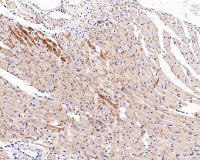 Immunohistochemistry-Paraffin: E-Cadherin Antibody (ST54-01) [NBP2-67540]
