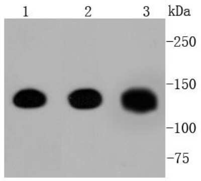Western Blot: E-Cadherin Antibody (ST54-01) [NBP2-67540]