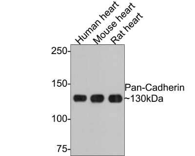 Western Blot: E-Cadherin Antibody (ST54-01) [NBP2-67540]