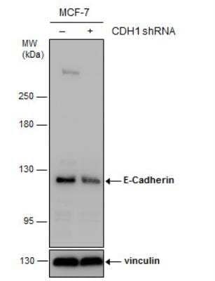 Western Blot: E-Cadherin Antibody [NBP2-16258]