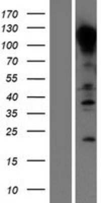 Western Blot: E-Cadherin Overexpression Lysate [NBL1-09024]