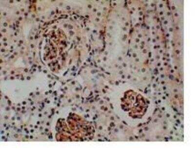 Immunohistochemistry-Paraffin: E-Selectin/CD62E Antibody (RM0034-9J12) - Azide and BSA Free [NB110-85473]