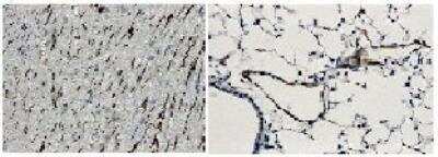 Immunohistochemistry-Paraffin: E-Selectin/CD62E Antibody (RM0034-9J12) - Azide and BSA Free [NB110-85473]