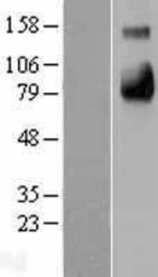 Western Blot: E-Selectin/CD62E Overexpression Lysate [NBL1-15790]