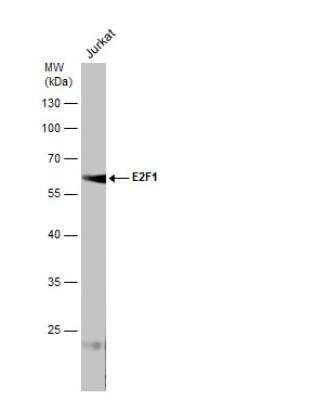 Western Blot: E2F-1 Antibody (16G7) [NB600-210]