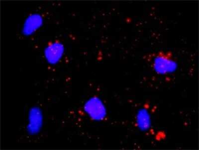 Proximity Ligation Assay: E2F-1 Antibody (2E10) [H00001869-M01]