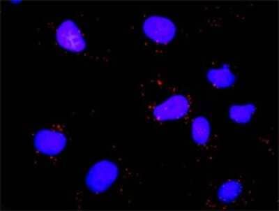 Proximity Ligation Assay: E2F-1 Antibody (2E10) [H00001869-M01]