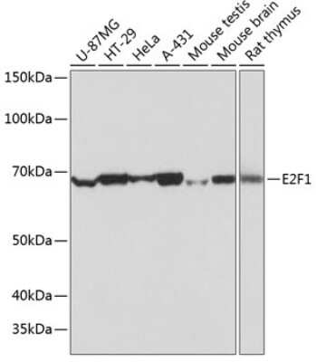 Western Blot: E2F-1 Antibody (5Z5U3) [NBP3-15785]