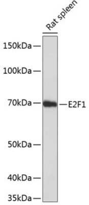 Western Blot: E2F-1 Antibody (5Z5U3) [NBP3-15785]