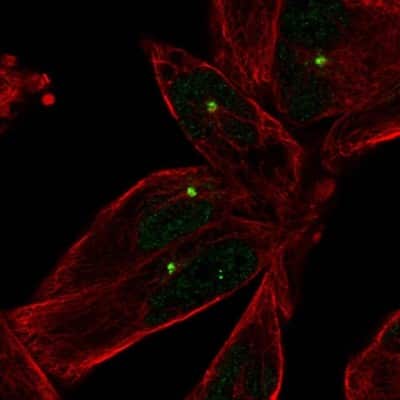 Immunocytochemistry/ Immunofluorescence: E2F-1 Antibody [NBP2-56716]