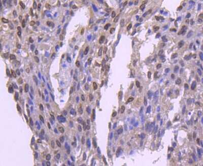 Immunohistochemistry-Paraffin: E2F-1 Antibody (JJ092-02) [NBP2-67899]