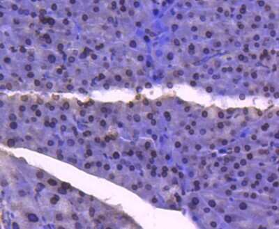 Immunohistochemistry-Paraffin: E2F-1 Antibody (JJ092-02) [NBP2-67899]