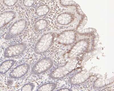 Immunohistochemistry-Paraffin: E2F-1 Antibody (JJ092-02) [NBP2-67899]