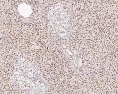 Immunohistochemistry-Paraffin: E2F-1 Antibody (JJ092-02) [NBP2-67899]